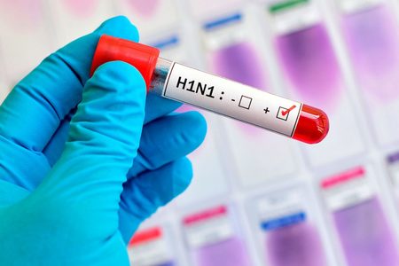 Left or right h1n1 divulgacao gripe influenza a